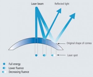 wavefront laser